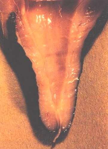 Anatomía de la ubre Pezón individual Tejido suave en la cisterna del pezón Se puede volver áspero debido al sobreordeño y a mala estimulación La queratina esta en el canal para proteger la