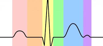 MONITORIZACIÓN ELÉCTRICA: ECG Cambios en la frecuencia cardiaca Alteraciones de la generación