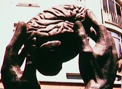 Muerte Encefálica Pérdida total e irreversible de todas las funciones del tronco y hemisferios cerebrales.