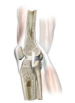 Disco cartilaginoso Articulaciones móviles Son articulaciones como, por ejemplo, el codo, la rodilla o la cadera, que permiten el movimiento de los huesos en todas las direcciones.