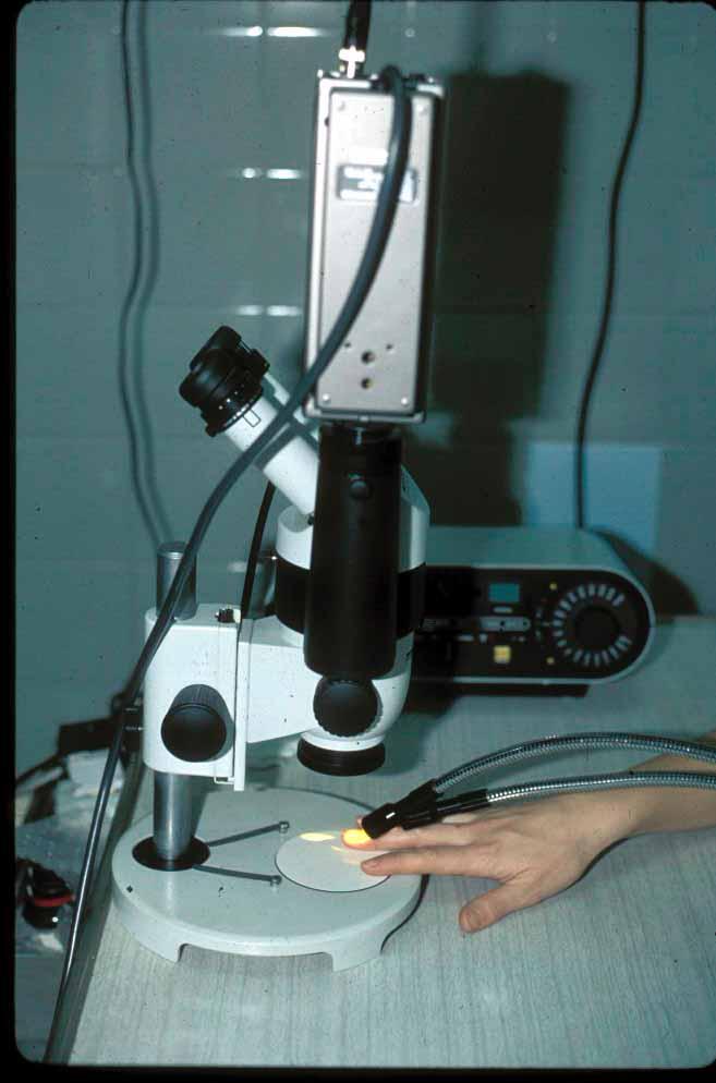 CAPILAROSCOPIA Técnica Simple-incruenta Microscopio óptico 50 200 aumentos Luz fría Método