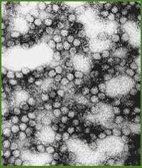 Fiebre Amarilla Enfermedad aguda febril Agente: virus fiebre amarilla RNA, familia flaviviridae Transmitida por vector (mosquito) Presente