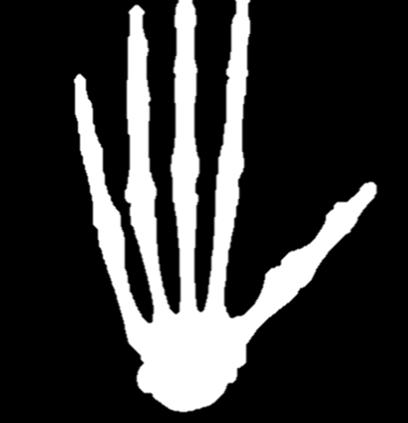 1.1.4 Orientación del dedo pulgar en la palma. De acuerdo a [1] el pulgar se encuentra colocado fuera de la región que contiene a los dedos.