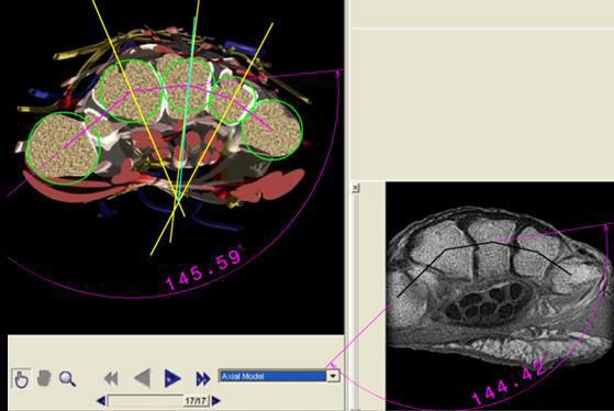 C) vista del MRI de mano humana real. En la imagen A) y B) se muestran algunos ángulos estimados.