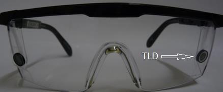 Desarrollo de las gafas para la medición de dosis en cristalino TLDs ubicados en los extremos