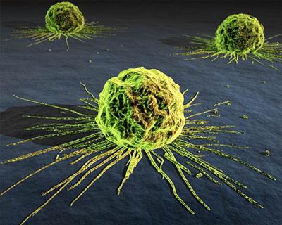 Según Warburg "Todas las células normales tienen un requisito absoluto para el oxígeno, pero las células cancerosas pueden vivir sin oxígeno - una regla sin excepción.