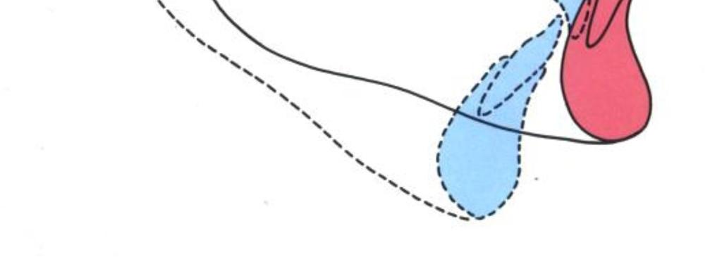 posición de los incisivos superiores manifiestan una inclinación palatina.