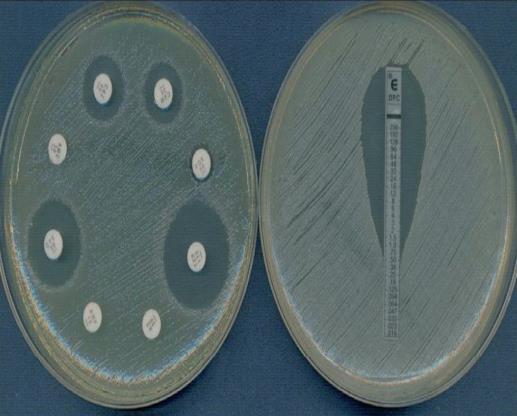 El estudio de la sensibilidad in vitro de las bacterias a los antimicrobianos se realiza mediante: 1.