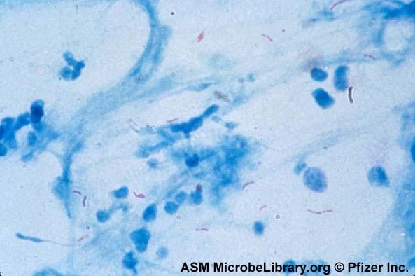 Género Mycobacterium Myces = hongo; bacterium = pequeña varilla Aerobio, inmóvil, no esporulado, 0,2-0,6 x 1-10m Resistentes: lípidos de la pared Ácido-alcohol resistentes (ác.