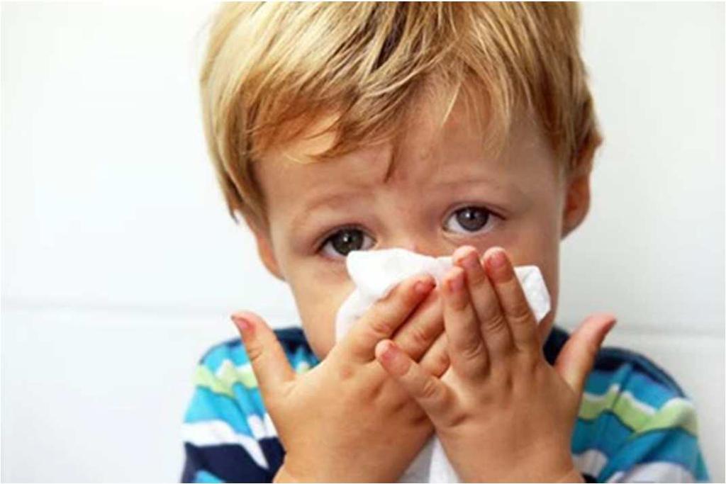 Caso de síndrome gripal (SG) o enfermedad tipo influenza (ETI)