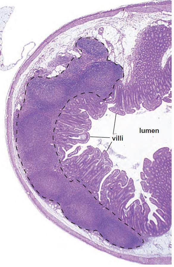Órganos linfoideos secundarios - MALT MALT (Tejido linfoideo asociado a