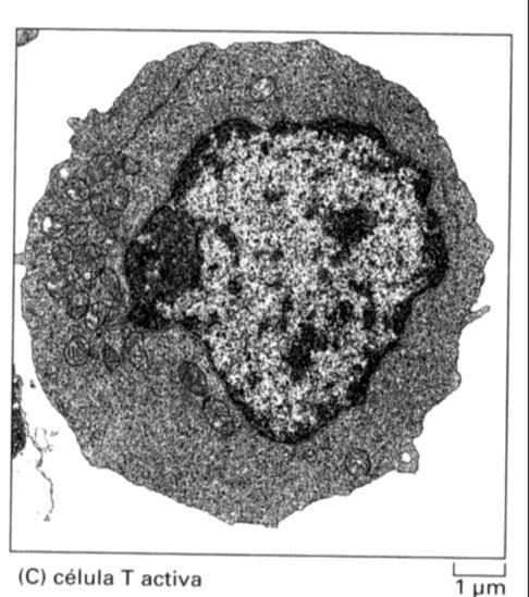 Células del tejido linfoideo Linfocitos