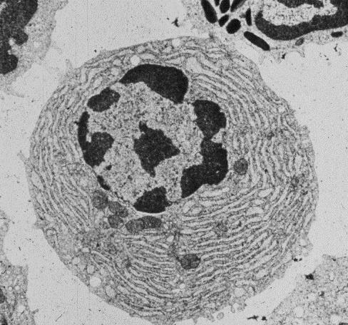 Células del tejido linfoideo Linfocitos B activados Respuesta