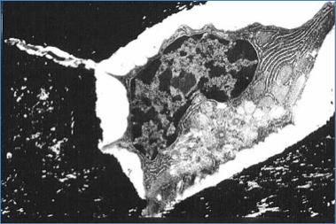 FORMACIÓN DE LA MATRIZ CALCIFICADA Mineralización: consiste en la calcificación de la osteoide. Para ello: - Depósito de cristales de hidroxiapatita sobre la osteoide.