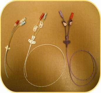Tipos de dispositivos intravasculares (DIV) ó catéteres