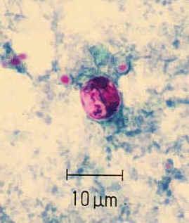 Ciclospora sp OOQUISTE Tamaño de 8-10 µ Esférica Membrana delgada y un citoplasma trasnparente, con dos