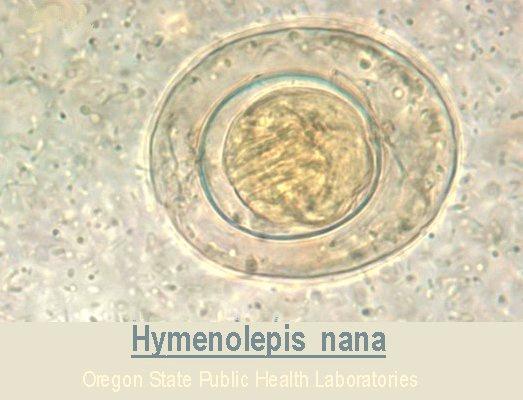 HUEVO Hymenolepis nana Redondo u ovalado Tamaño: 40 50 μ Doble Membrana Filamentos en forma de