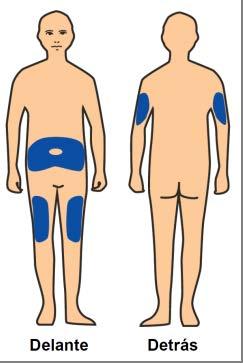 Se debe inyectar en el muslo, el abdomen o en la parte superior posterior del brazo (ver la imagen a la izquierda). Debe utilizarse un lugar diferente para cada nueva inyección.
