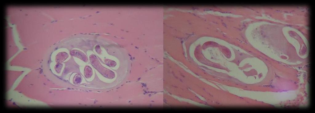 A B Fig. 11. Control infectado. En A). Se identifica célula nodriza de T. spiralis con poca infiltración celular aparente mente viables. B).