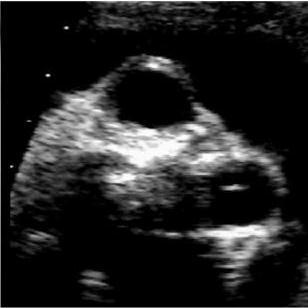 Copel J, D alton M, Gratacós E. Obstetric Imaging.