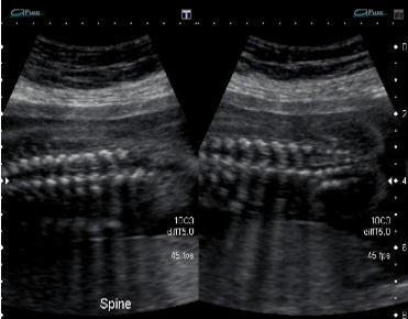 Fetal Diagn Ther. 2015;37(3):179-96. www.ultrasoundpaedia.
