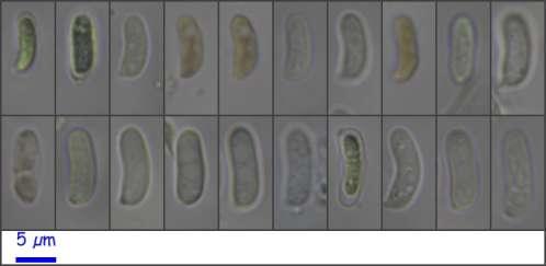 Descripción microscópica: Esporas hialinas, cilíndricas-elipsoidales, reniformes, apiculadas, de (7,9-) 8,2-10,1 (-11,3) x (2,4-) 2,6-3,4 (-3,7) µm Q = (2.