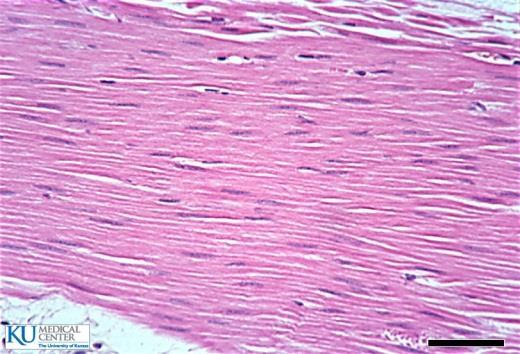MUSCULAR Células en forma de fibras Contracción Tipos: Muscular