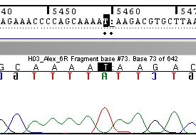 Mutaciones puntuales ESTUDIO GENÉTICO DEL GEN DMD Mutación indel (inserción-deleción) Paciente DMD Exón 36: la deleción de AG e inserción de T desplaza la pauta de lectura.