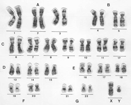 3. Observa la siguiente e imagen y contesta: - Qué se representa en esta imagen?. - Cuántos cromosomas hay?