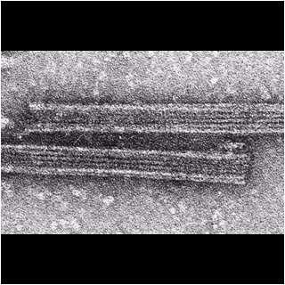 Microtúbulos... 24 nm diam. 19.1, 22.1 Lodish, H. et al. 2002.