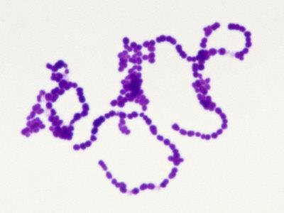 Los Streptococcus del grupo A proteína M une