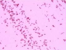Bacilos Gram negativos No esporulados Aerobios No