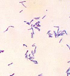 Bacilos Gram (+) AEROBIO No esporulados NO patógenos Comensales /oportunistas Corynebacterium spp ( bacilos diferoides) ( C.urealyticum,C. jeikenium, C. xerosis, etc.