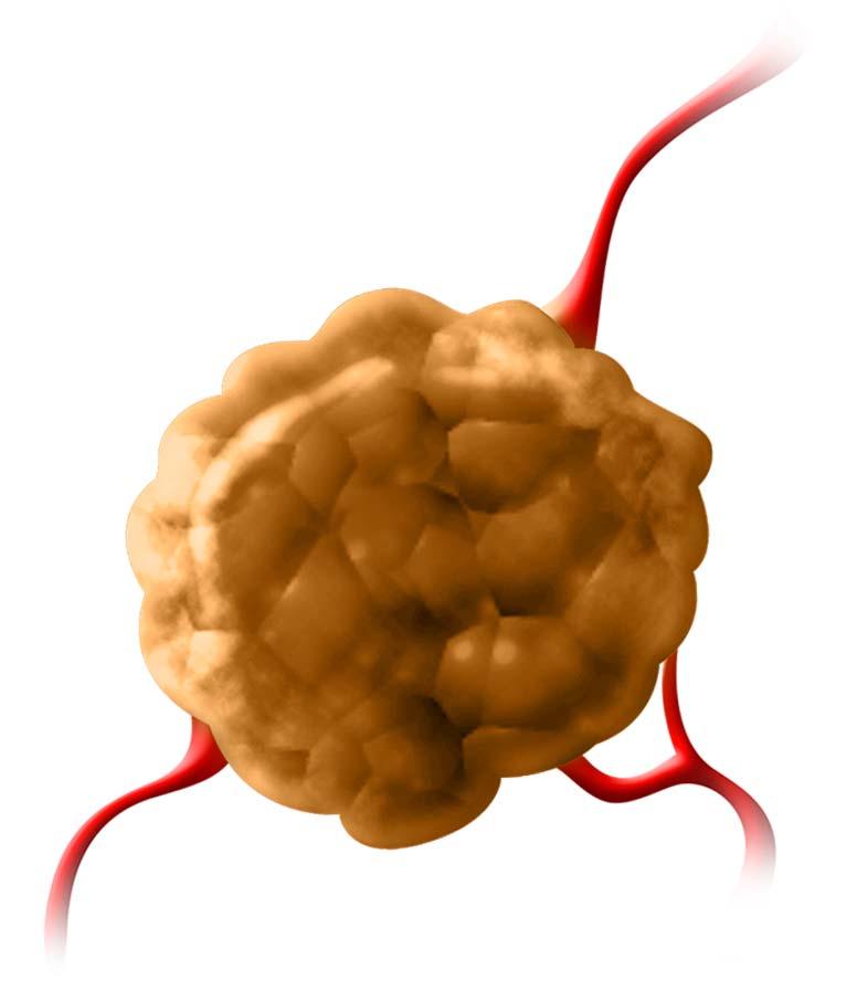 La evasión de la respuesta inmune es una característica emergente del cáncer 1 Características emergentes Las células