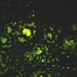 Determinación de bacterias-amonio oxidantes (rojo) y bacterias nitrito-oxidantes (verde) con método cualitativo de