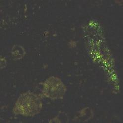 Microscopio confocal láser de barrido Las imágenes de la izquierda corresponden a una muestra tomada de las capas