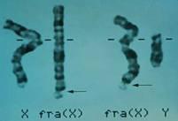 existen 2 tipos de cromosomas: - Cromosomas