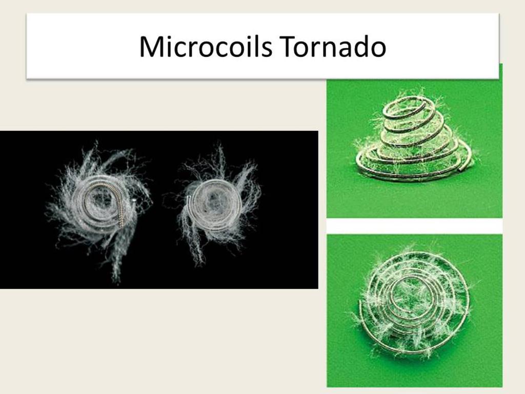 Fig. 7: Microcoils tipo Tornado utilizados para