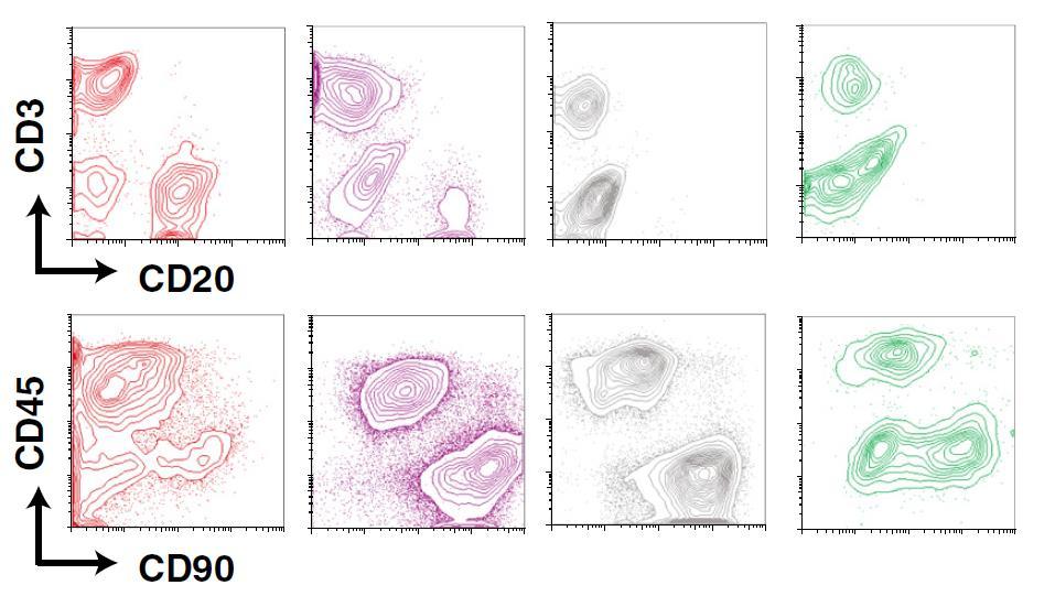 Marcador de macrófagos Marcador de linfocitos T Los componentes inmunes intervienen de manera distinta sobre los fenotipos de la patología sinovial de la AR En la AR, existe una variación