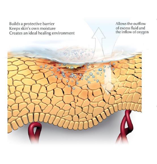 UNA BARRERA SEMI-OCLUSIVA ÚNICA Crea una barrera de protección que mantiene la humedad natural de la piel Permite la salida del exceso de humedad y el ingreso de oxígeno Ungüentos oclusivos (ej.