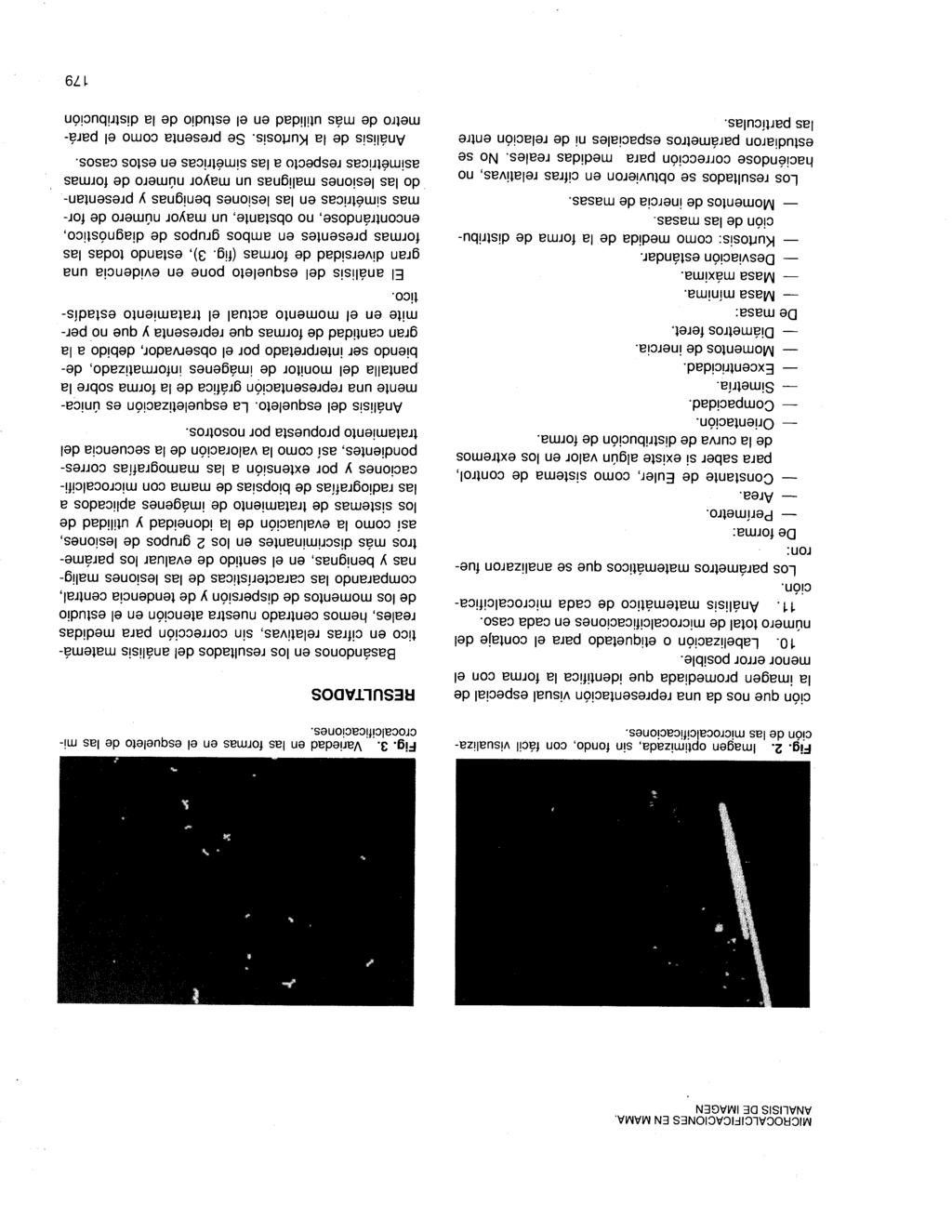 MICROCALCIFICACIONES EN MAMA. ANALISIS DE IMAGEN Fig. 2. Imagen optimizada, sin fondo, con fácil visualización de las microcalcificaciones.