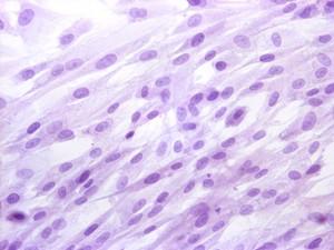En la actualidad, el cordón umbilical constituye una importante fuente de células madre para la medicina regenerativa y la construcción de tejidos artificiales.
