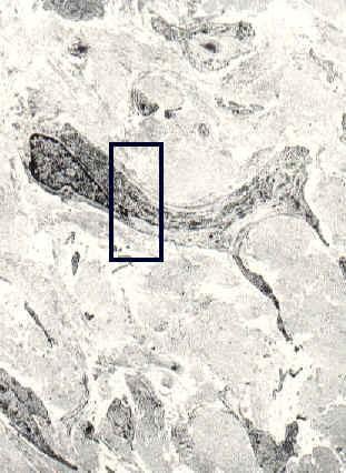 A la izquierda un miofibroblasto del tejido conectivo del paladar humano.