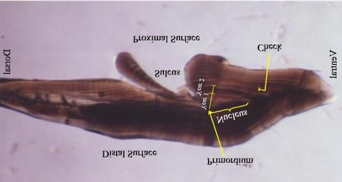 Figura 3: Características asociadas a una sección de otolito de Dissostichus