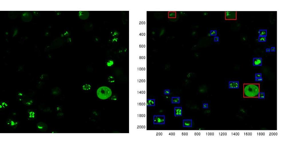 I 3 A Identificación de células con proteina traslocada en imágenes de microscopía Reconocimiento de formas