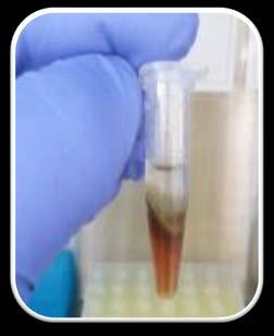 PCR Extracción