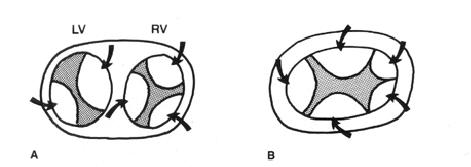 Clasificación Completo (DSAV común) Defecto valvular común Válvula con 5 velos. Rastelli (según cabalgamiento de velo superior).