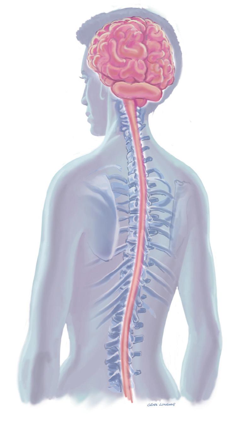ESCLEROSIS MÚLTIPLE : UNA BREVE DESCRIPCIÓN La esclerosis múltiple (EM) causa una inflamación que impide el paso de las señales eléctricas entre las células nerviosas del sistema nervioso central.