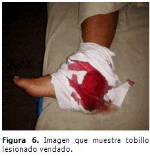 Gustavo Aldereguía Lima tras sufrir una caída desde un coche.