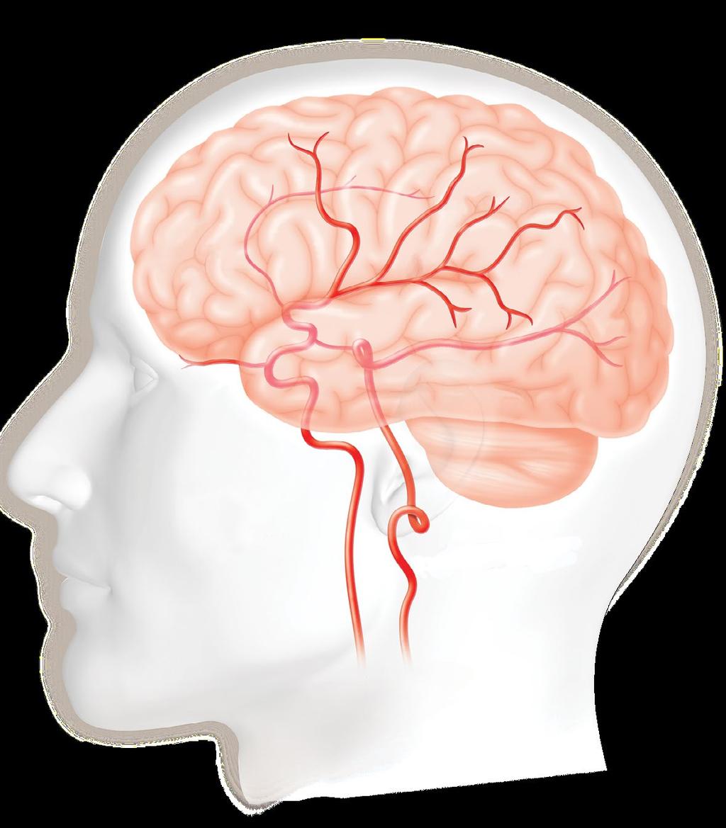 Qué es un ataque cerebrovascular? Los vasos sanguíneos que llevan la sangre del corazón al cerebro se llaman arterias.